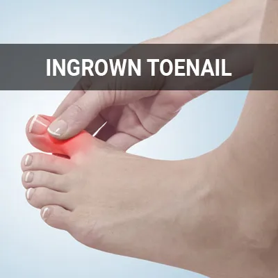 Visit our Ingrown Toenail page