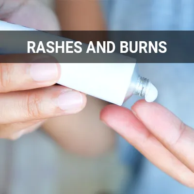 Visit our Rashes and Burns page