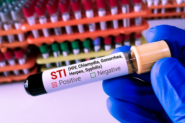 What To Expect During An STD Testing Appointment